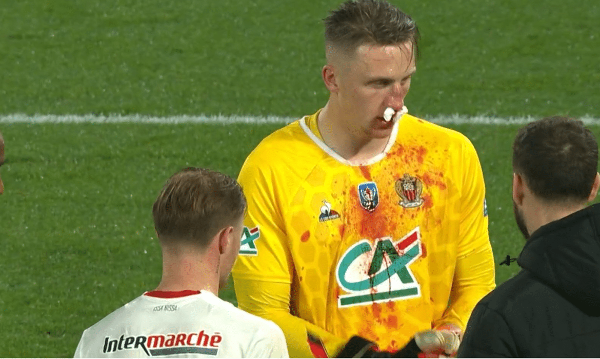 Marcin Bułka znokautowany. Najpierw fatalny błąd, a potem uraz